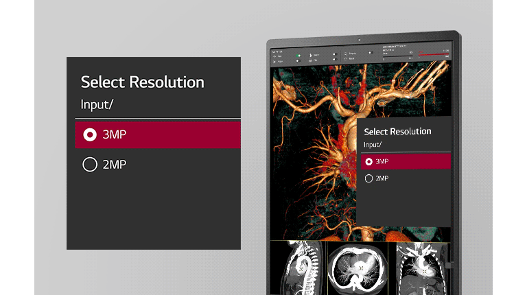 Monitor de diagnóstico IPS LG de 21,3» y 3 MP Monitor de diagnóstico IPS LG de 31.5