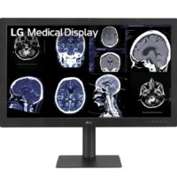 Monitor de diagnóstico LG IPS Black de 31,5" y 8 MP