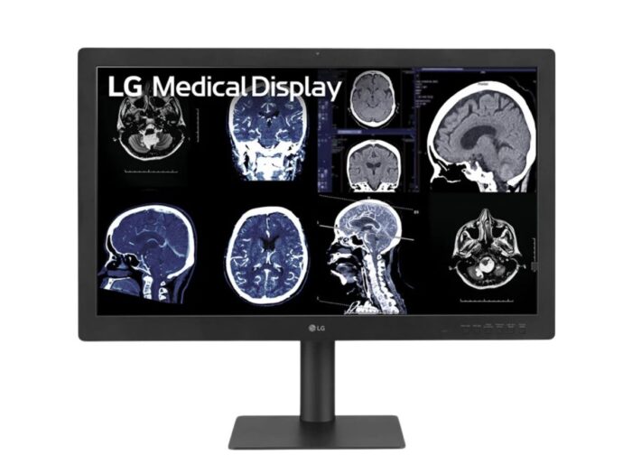 Monitor de diagnóstico LG IPS Black de 31,5" y 8 MP