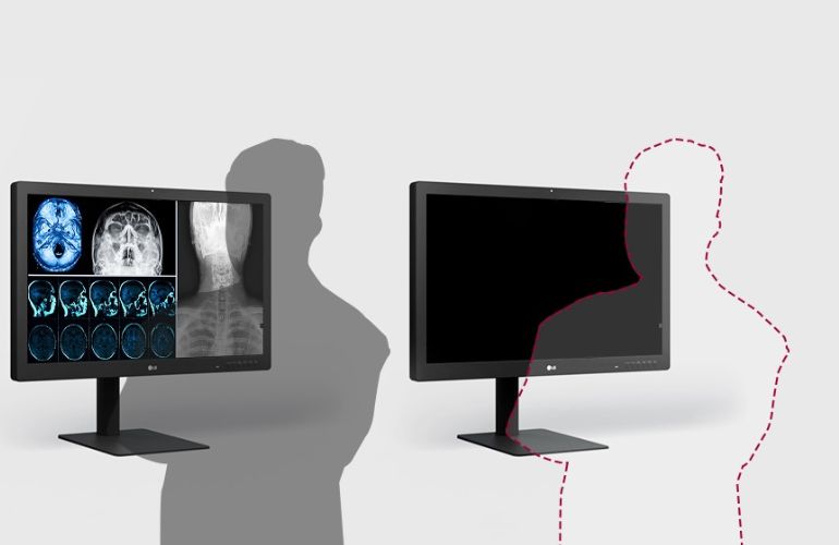 monitor-diagnostico-ips-black-315-8mp Monitor de diagnóstico LG IPS Black de 31,5