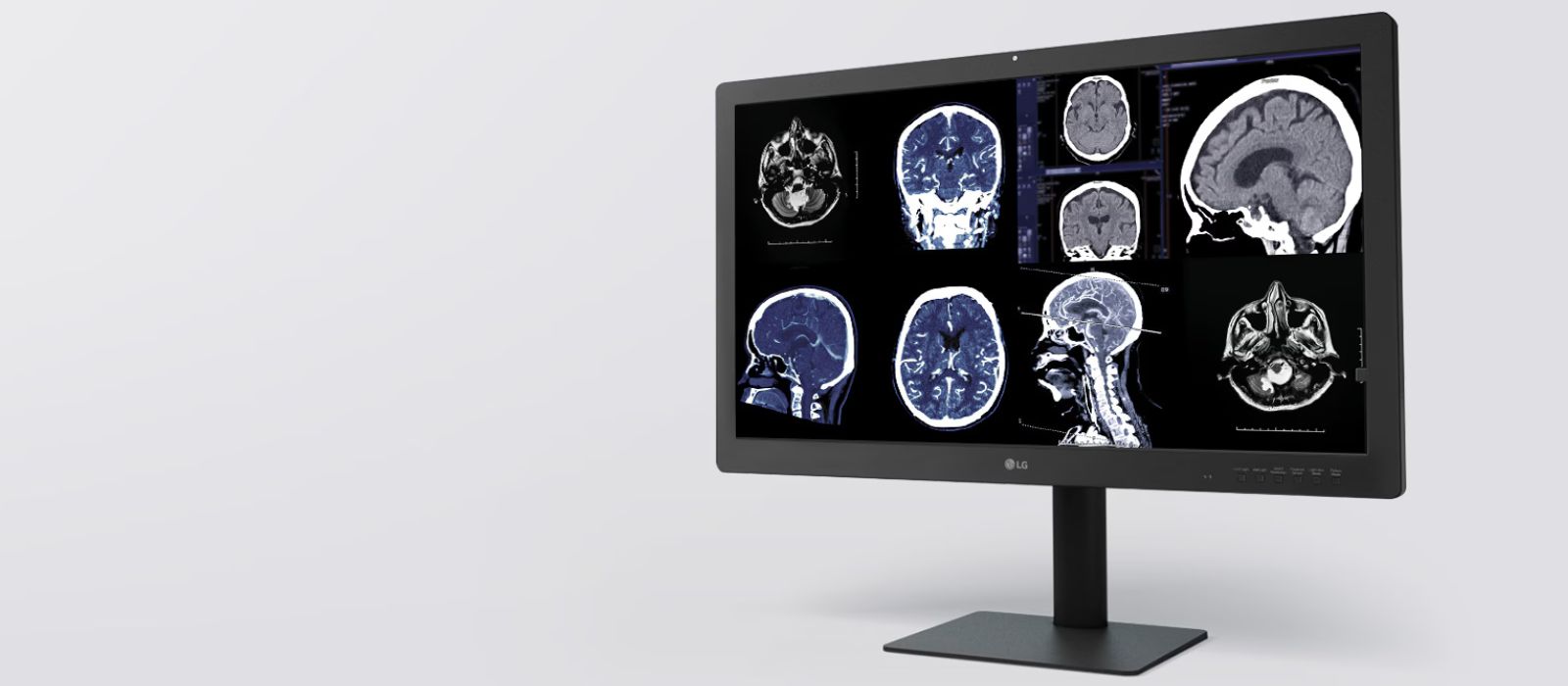 monitor-diagnostico-ips-black-315-8mp Monitor de diagnóstico IPS LG de 31.5