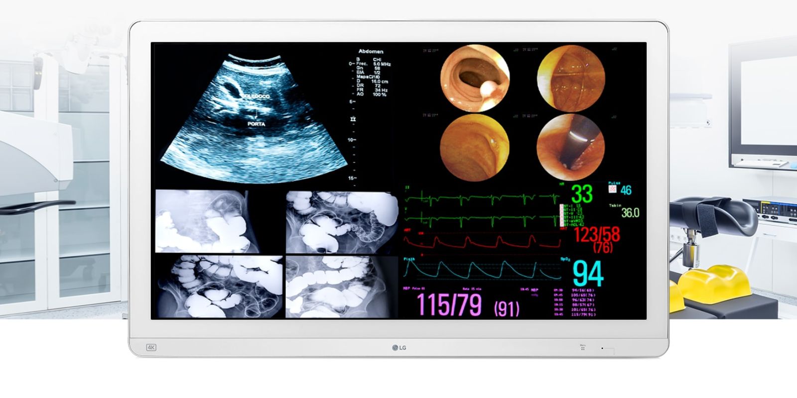 monitor-quirurgico-ips-4k-315-12g-sdi-1 Monitor Quirúrgico IPS 4K de 31,5'' de LG